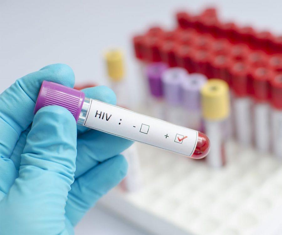 Quase 200 mil brasileiros vivem com HIV e não fazem tratamento