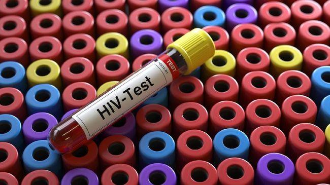 Quase 200 mil brasileiros vivem com HIV e não fazem tratamento